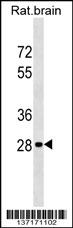 Rat Hoxd9 Antibody (Center) (Cat. #AP17566c) western blot analysis in rat brain tissue lysates (35ug/lane).This demonstrates the Hoxd9 antibody detected the Hoxd9 protein (arrow).