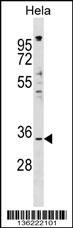 IMPACT Antibody (N-term) (Cat. #AP17553a) western blot analysis in Hela cell line lysates (35ug/lane).This demonstrates the IMPACT antibody detected the IMPACT protein (arrow).