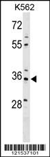 PDLIM4 Antibody (Center) (Cat. #AP17994c) western blot analysis in K562 cell line lysates (35ug/lane).This demonstrates the PDLIM4 antibody detected the PDLIM4 protein (arrow).