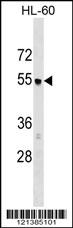 AP3M1 Antibody (C-term) (Cat. #AP17992b) western blot analysis in HL-60 cell line lysates (35ug/lane).This demonstrates the AP3M1 antibody detected the AP3M1 protein (arrow).