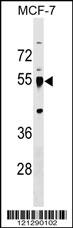 LRRC42 Antibody (Center) (Cat. #AP17990c) western blot analysis in MCF-7 cell line lysates (35ug/lane).This demonstrates the LRRC42 antibody detected the LRRC42 protein (arrow).