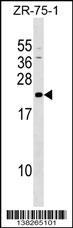 GRPEL1 Antibody (Center) (Cat. #AP17977c) western blot analysis in ZR-75-1 cell line lysates (35ug/lane).This demonstrates the GRPEL1 antibody detected the GRPEL1 protein (arrow).
