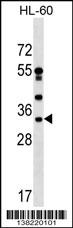 DNAJC17 Antibody (C-term) (Cat. #AP17966b) western blot analysis in HL-60 cell line lysates (35ug/lane).This demonstrates the DNAJC17 antibody detected the DNAJC17 protein (arrow).