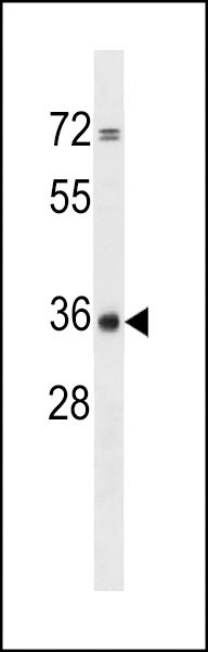 CPPED1 Antibody (C-term) (Cat. #AP17964b) western blot analysis in ZR-75-1 cell line lysates (35ug/lane).This demonstrates the CPPED1 antibody detected the CPPED1 protein (arrow).