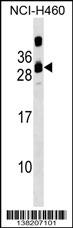 CIB3 Antibody (N-term) (Cat. #AP17961a) western blot analysis in NCI-H460 cell line lysates (35ug/lane).This demonstrates the CIB3 antibody detected the CIB3 protein (arrow).