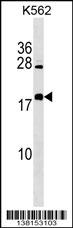 BEX4 Antibody (Center) (Cat. #AP17957c) western blot analysis in K562 cell line lysates (35ug/lane).This demonstrates the BEX4 antibody detected the BEX4 protein (arrow).