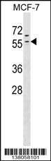 ZNF383 Antibody (N-term) (Cat. #AP17940a) western blot analysis in MCF-7 cell line lysates (35ug/lane).This demonstrates the ZNF383 antibody detected the ZNF383 protein (arrow).