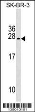 TUSC5 Antibody (Center) (Cat. #AP17939c) western blot analysis in SK-BR-3 cell line lysates (35ug/lane).This demonstrates the TUSC5 antibody detected the TUSC5 protein (arrow).