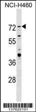 RNF207 Antibody (C-term) (Cat. #AP17923b) western blot analysis in NCI-H460 cell line lysates (35ug/lane).This demonstrates the RNF207 antibody detected the RNF207 protein (arrow).