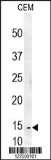 CRCT1 Antibody (N-term) (Cat. #AP10028a) western blot analysis in CEM cell line lysates (35ug/lane).This demonstrates the CRCT1 antibody detected the CRCT1 protein (arrow).
