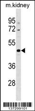 CCDC91 Antibody (C-term) (Cat. #AP17920b) western blot analysis in mouse kidney tissue lysates (35ug/lane).This demonstrates the CCDC91 antibody detected the CCDC91 protein (arrow).