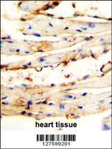 CRCT1 antibody (N-term) (Cat. #AP10028a) immunohistochemistry analysis in formalin fixed and paraffin embedded mouse heart tissue followed by peroxidase conjugation of the secondary antibody and DAB staining. This data demonstrates the use of the CRCT1 antibody (N-term) for immunohistochemistry. Clinical relevance has not been evaluated.