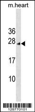 INCA1 Antibody (N-term) (Cat. #AP17905a) western blot analysis in mouse heart tissue lysates (35ug/lane).This demonstrates the INCA1 antibody detected the INCA1 protein (arrow).