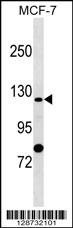 SLC4A9 Antibody (N-term) (Cat. #AP17903a) western blot analysis in MCF-7 cell line lysates (35ug/lane).This demonstrates the SLC4A9 antibody detected the SLC4A9 protein (arrow).
