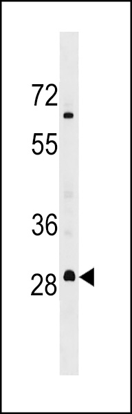 MARH3 Antibody (C-term) (Cat. #AP17902b) western blot analysis in MDA-MB453 cell line lysates (35ug/lane).This demonstrates the MARH3 antibody detected the MARH3 protein (arrow).