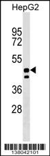 UNC93A Antibody (N-term) (Cat. #AP17862a) western blot analysis in HepG2 cell line lysates (35ug/lane).This demonstrates the UNC93A antibody detected the UNC93A protein (arrow).