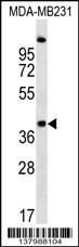 RQCD1 Antibody (Center) (Cat. #AP17848c) western blot analysis in MDA-MB231 cell line lysates (35ug/lane).This demonstrates the RQCD1 antibody detected the RQCD1 protein (arrow).