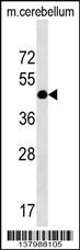 RQCD1 Antibody (Center) (Cat. #AP17848c) western blot analysis in mouse cerebellum tissue lysates (35ug/lane).This demonstrates the RQCD1 antibody detected the RQCD1 protein (arrow).
