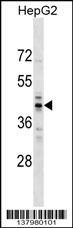 RG9MTD2 Antibody (Center) (Cat. #AP17846c) western blot analysis in HepG2 cell line lysates (35ug/lane).This demonstrates the RG9MTD2 antibody detected the RG9MTD2 protein (arrow).