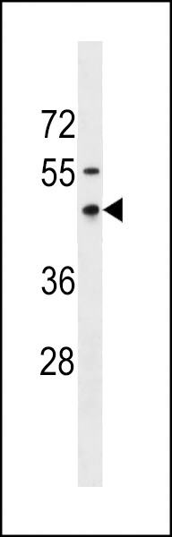 RNFT1 Antibody (N-term) (Cat. #AP17838a) western blot analysis in MDA-MB231 cell line lysates (35ug/lane).This demonstrates the RNFT1 antibody detected the RNFT1 protein (arrow).