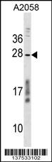 CCDC144NL Antibody (C-term) (Cat. #AP17821b) western blot analysis in A2058 cell line lysates (35ug/lane).This demonstrates the CCDC144NL antibody detected the CCDC144NL protein (arrow).