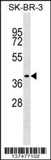TRAM1 Antibody (C-term) (Cat. #AP17814b) western blot analysis in SK-BR-3 cell line lysates (35ug/lane).This demonstrates the TRAM1 antibody detected the TRAM1 protein (arrow).