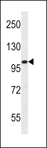 FIL1L Antibody (N-term) (Cat. #AP18152a) western blot analysis in ZR-75-1 cell line lysates (35ug/lane).This demonstrates the FIL1L antibody detected the FIL1L protein (arrow).
