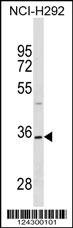 TSPAN18 Antibody (Center) (Cat. #AP18147c) western blot analysis in NCI-H292 cell line lysates (35ug/lane).This demonstrates the TSPAN18 antibody detected the TSPAN18 protein (arrow).