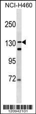 DSPP Antibody (N-term) (Cat. #AP18118a) western blot analysis in NCI-H460 cell line lysates (35ug/lane).This demonstrates the DSPP antibody detected the DSPP protein (arrow).