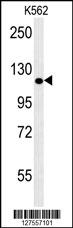 POTEE Antibody (Center) (Cat. #AP10010c) western blot analysis in K562 cell line lysates (35ug/lane).This demonstrates the POTEE antibody detected the POTEE protein (arrow).