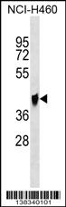 QPCTL Antibody (C-term) (Cat. #AP18106b) western blot analysis in NCI-H460 cell line lysates (35ug/lane).This demonstrates the QPCTL antibody detected the QPCTL protein (arrow).