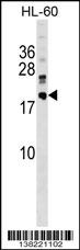 DNAJC30 Antibody (C-term) (Cat. #AP18088b) western blot analysis in HL-60 cell line lysates (35ug/lane).This demonstrates the DNAJC30 antibody detected the DNAJC30 protein (arrow).