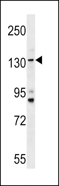 TMC5 Antibody (Center) (Cat. #AP18075c) western blot analysis in HL-60 cell line lysates (35ug/lane).This demonstrates the TMC5 antibody detected the TMC5 protein (arrow).