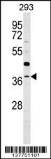 RG9MTD3 Antibody (Center) (Cat. #AP18072c) western blot analysis in 293 cell line lysates (35ug/lane).This demonstrates the RG9MTD3 antibody detected the RG9MTD3 protein (arrow).