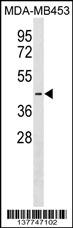 PJVK Antibody (Center) (Cat. #AP18071c) western blot analysis in MDA-MB453 cell line lysates (35ug/lane).This demonstrates the PJVK antibody detected the PJVK protein (arrow).