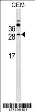 MS4A3 Antibody (Center) (Cat. #AP18066c) western blot analysis in CEM cell line lysates (35ug/lane).This demonstrates the MS4A3 antibody detected the MS4A3 protein (arrow).