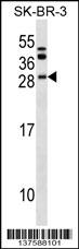 BCL7C Antibody (N-term) (Cat. #AP18065a) western blot analysis in SK-BR-3 cell line lysates (35ug/lane).This demonstrates the BCL7C antibody detected the BCL7C protein (arrow).