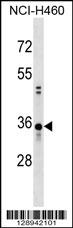 CCDC137 Antibody (C-term) (Cat. #AP18043b) western blot analysis in NCI-H460 cell line lysates (35ug/lane).This demonstrates the CCDC137 antibody detected the CCDC137 protein (arrow).