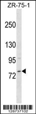 MICALCL Antibody (N-term) (Cat. #AP18039a) western blot analysis in ZR-75-1 cell line lysates (35ug/lane).This demonstrates the MICALCL antibody detected the MICALCL protein (arrow).