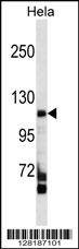 FAM65C Antibody (C-term) (Cat. #AP18035b) western blot analysis in Hela cell line lysates (35ug/lane).This demonstrates the FAM65C antibody detected the FAM65C protein (arrow).