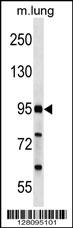FCHO2 Antibody (Center) (Cat. #AP18034c) western blot analysis in mouse lung tissue lysates (35ug/lane).This demonstrates the FCHO2 antibody detected the FCHO2 protein (arrow).