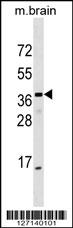 ELMOD1 Antibody (Center) (Cat. #AP18029c) western blot analysis in mouse brain tissue lysates (35ug/lane).This demonstrates the ELMOD1 antibody detected the ELMOD1 protein (arrow).