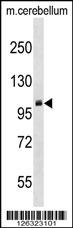 PRMT10 Antibody (N-term) (Cat. #AP18025a) western blot analysis in mouse cerebellum tissue lysates (35ug/lane).This demonstrates the PRMT10 antibody detected the PRMT10 protein (arrow).