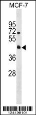 R4RL2 Antibody (C-term) (Cat. #AP18016b) western blot analysis in MCF-7 cell line lysates (35ug/lane).This demonstrates the R4RL2 antibody detected the R4RL2 protein (arrow).