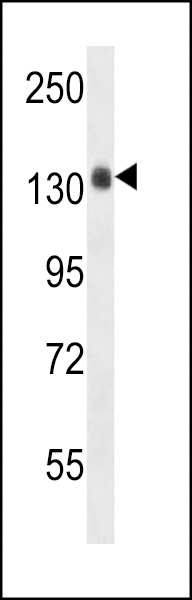 COL4A5 Antibody (N-term) (Cat. #AP18346a) western blot analysis in CEM cell line lysates (35ug/lane).This demonstrates the COL4A5 Antibody detected the COL4A5 protein (arrow).