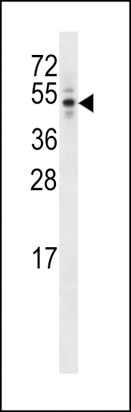 K1712 Antibody (C-term) (Cat. #AP18343b) western blot analysis in T47D cell line lysates (35ug/lane).This demonstrates the K1712 Antibody detected the K1712 protein (arrow).