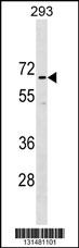 CCDC151 Antibody (N-term) (Cat. #AP18339a) western blot analysis in 293 cell line lysates (35ug/lane).This demonstrates the CCDC151 Antibody detected the CCDC151 protein (arrow).