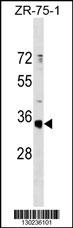 OR51G1 Antibody (C-term) (Cat. #AP18334b) western blot analysis in ZR-75-1 cell line lysates (35ug/lane).This demonstrates the OR51G1 Antibody detected the OR51G1 protein (arrow).