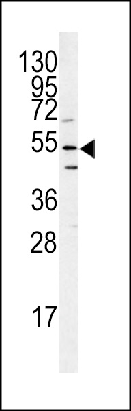 Western blot analysis of ATG14 antibody (N-term) (Cat.# AP1832a) in mouse heart tissue lysates (35ug/lane). ATG14 (arrow) was detected using the purified Pab.