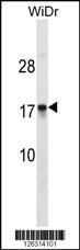 CDRT4 Antibody (Center) (Cat. #AP18326c) western blot analysis in WiDr cell line lysates (35ug/lane).This demonstrates the CDRT4 Antibody detected the CDRT4 protein (arrow).